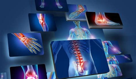 artrita reumatoida osteoartrita deformanta durere deasupra taliei din spate